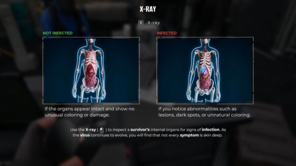 X-Ray description in The Last Check