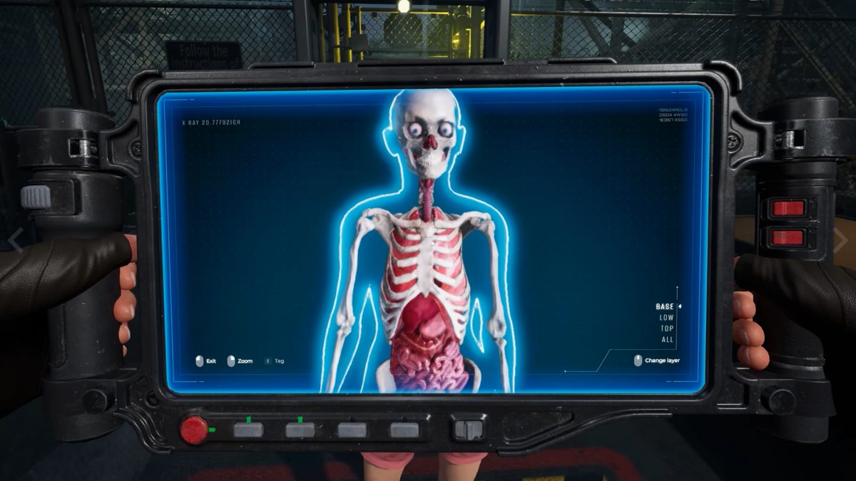 X-Ray image of survivor